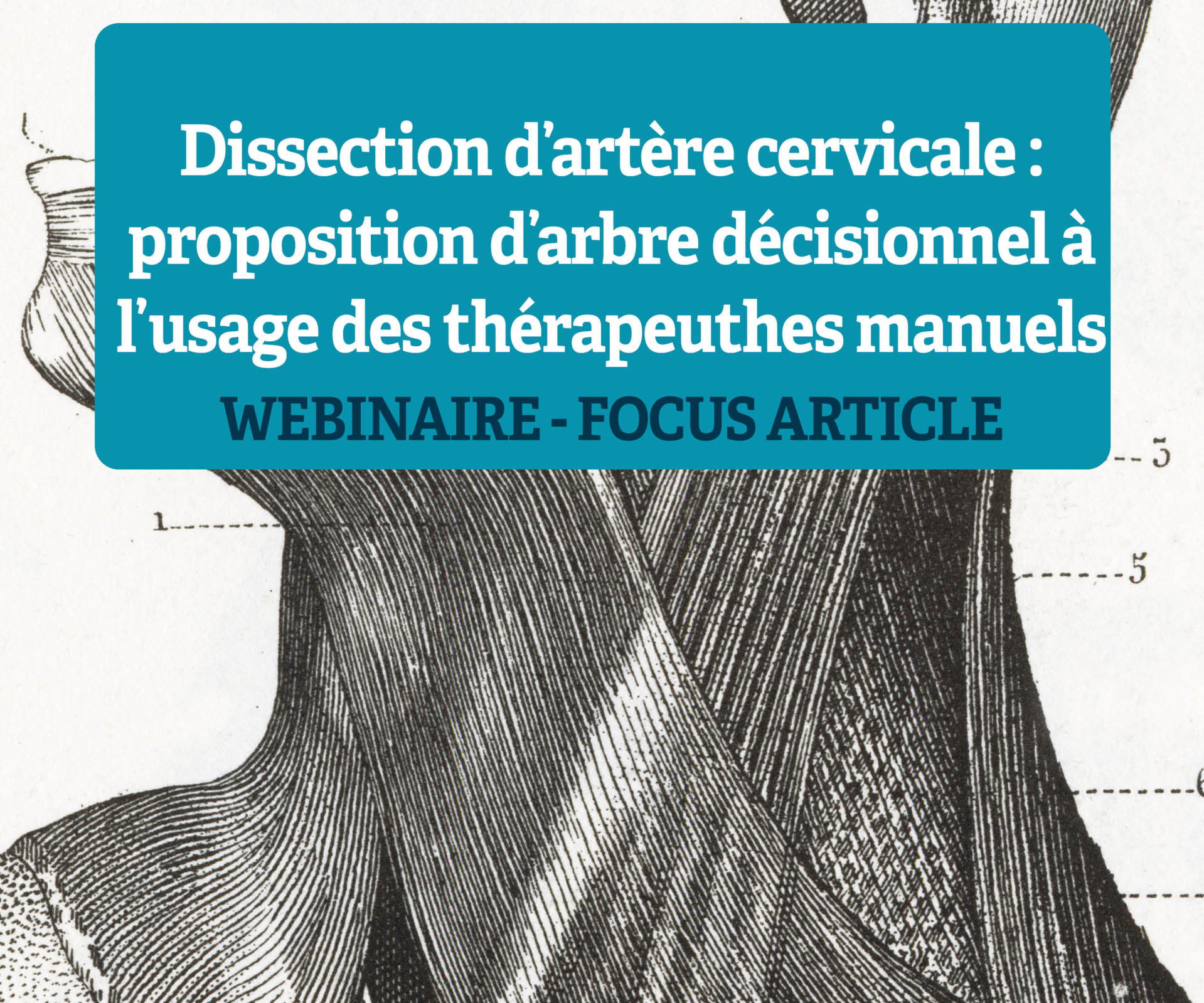 WEBINAIRE | Dissection d'artère cervicale - 24 juin 2025